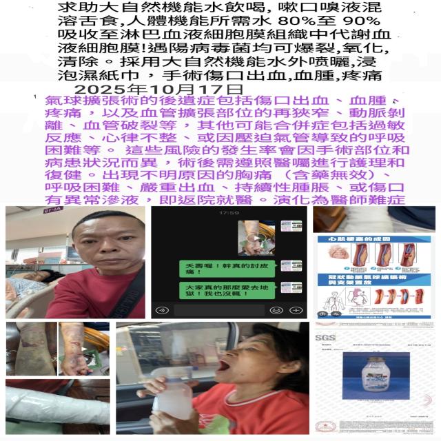 「氣球擴張術」治療心臟血管狹窄 「氣球擴張術」治療心臟血管狹窄