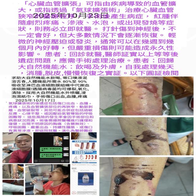 「氣球擴張術」治療心臟血管狹窄 「氣球擴張術」治療心臟血管狹窄